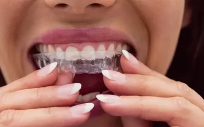 Invisalign cityName: Clear Aligner Therapy for Discreet Orthodontic Correction